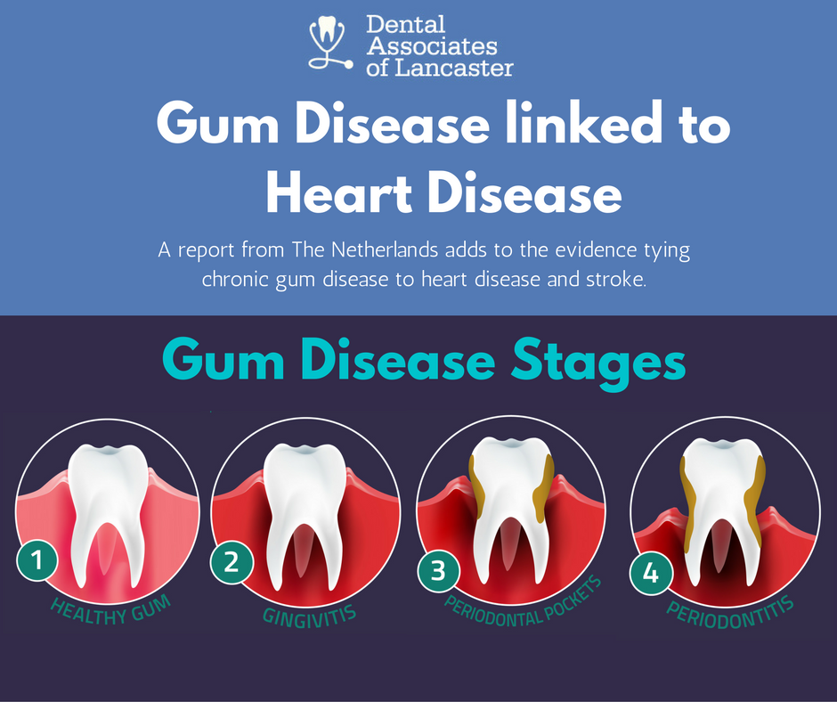 Gum disease linked to heart disease ad